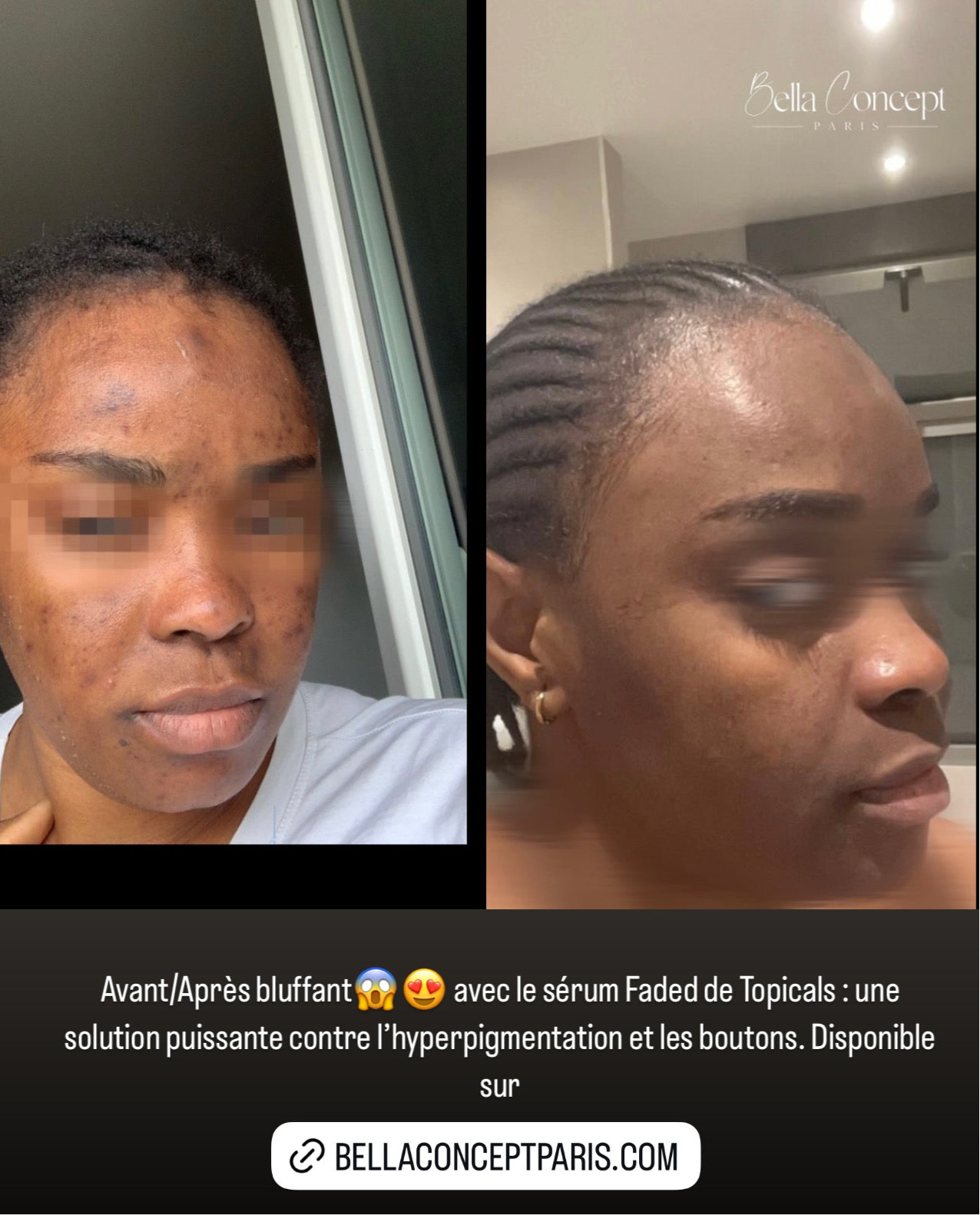 SERUM FADED TOPICALS 50 ML