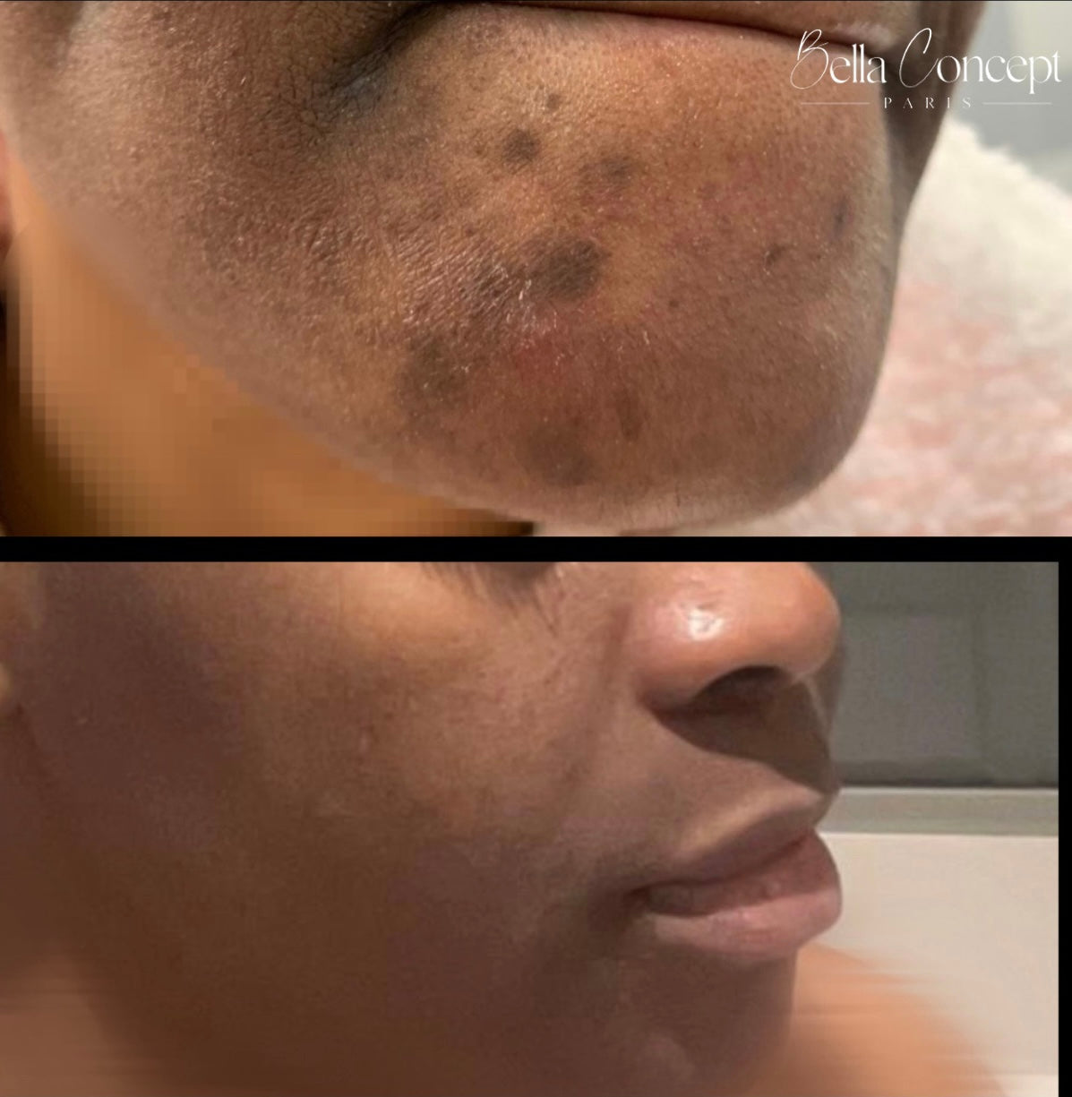 SERUM FADED TOPICALS 50 ML